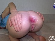 Deep anal - wide gaping ass 16/16