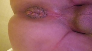 Sodomisation plug anal
