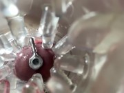 Super camera. Cumming in pussy from a catheter 15/16