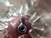 Super camera. Cumming in pussy from a catheter 2/16