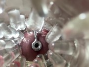 Super camera. Cumming in pussy from a catheter 3/16