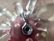 Super camera. Cumming in pussy from a catheter 5/16