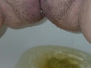 Bald and peeing 11/16