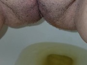 Bald and peeing 16/16
