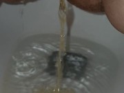 Bald and peeing 2/16