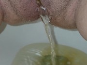 Bald and peeing 7/16