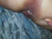 The green gooey substance from my asshole is homemade herbaly enhanced butt butter 3/16