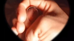 I masturbate and play with my penis
