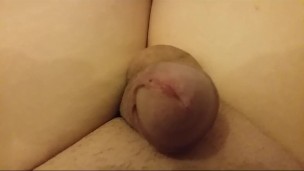 Masturbe (248) with one testicle
