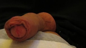 Masturbe (287) with one testicle