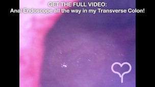 BEST Minicam Compilation in my Ass and Bladder - Get all Videos on Manyvids and Fansly!