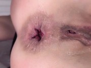 Anal Freak