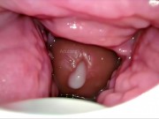 Cum Inside Me Over and Over! Camera inside Vagina Creampie Cervix POV 11/16