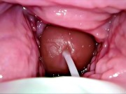 Cum Inside Me Over and Over! Camera inside Vagina Creampie Cervix POV 13/16
