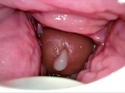 Cum Inside Me Over and Over! Camera inside Vagina Creampie Cervix POV 2/16