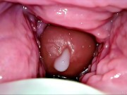 Cum Inside Me Over and Over! Camera inside Vagina Creampie Cervix POV 7/16