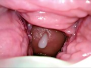 Cum Inside Me Over and Over! Camera inside Vagina Creampie Cervix POV 8/16