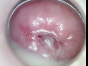 Super Creamy Dripping Gooey Mucus Cervix Thrusting Feels So Good 4/16