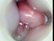 Super Creamy Dripping Gooey Mucus Cervix Thrusting Feels So Good 7/16