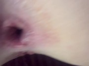 Open ass hole close-up 15/16