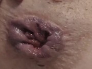 Watch My Asshole Gape & Prolapse After Relentless Butt Plug & Dildo Fucking! 11/16