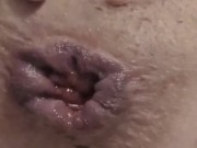 Watch My Asshole Gape & Prolapse After Relentless Butt Plug & Dildo Fucking! 12/16