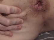 Watch My Asshole Gape & Prolapse After Relentless Butt Plug & Dildo Fucking! 7/16