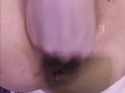 Destroyed & Gaping - Asshole & Pussy Fisting 3/16