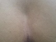 Asshole Close-Up While I Pee Outdoors 15/16