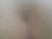 Asshole Close-Up While I Pee Outdoors 16/16