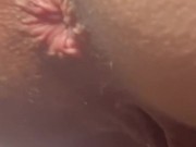 Watch My Asshole Twitch While I Pee Outdoors 16/16