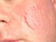 Face Biting Sophie 15/16