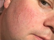 Face Biting Sophie 16/16