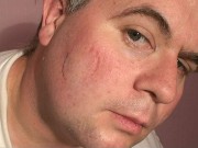 Face Biting Sophie 7/16