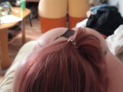 Attacked his dick and took out a sucker 5/16