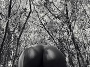 Black Girl with Mosquito bites on her  legs Alone in the forest 16/16