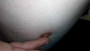 My body (1) with one testicle