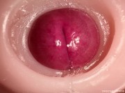 CLOSE UP CAMERA IN PUSSY: CUM Inside PUSSY TWICE! BEST CREAMPIE in 4K with Girl Moaning! 1/16