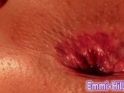 Teen Asshole close up! Tight Ass, huge Labia Pussy 7/16