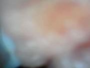 Endoscope camera shows the most sensitive parts of the penis Educational video 1/16