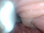 Endoscope camera shows the most sensitive parts of the penis Educational video 11/16