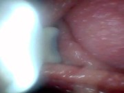 Endoscope camera shows the most sensitive parts of the penis Educational video 12/16