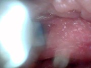 Endoscope camera shows the most sensitive parts of the penis Educational video 13/16