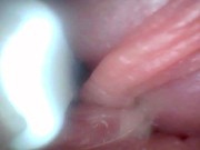 Endoscope camera shows the most sensitive parts of the penis Educational video 15/16