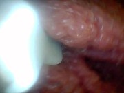 Endoscope camera shows the most sensitive parts of the penis Educational video 2/16