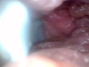 Endoscope camera shows the most sensitive parts of the penis Educational video 3/16