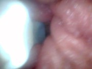 Endoscope camera shows the most sensitive parts of the penis Educational video 7/16