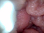 Endoscope camera shows the most sensitive parts of the penis Educational video 8/16
