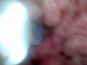 Endoscope camera shows the most sensitive parts of the penis Educational video 9/16