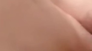 Micropene foreskin